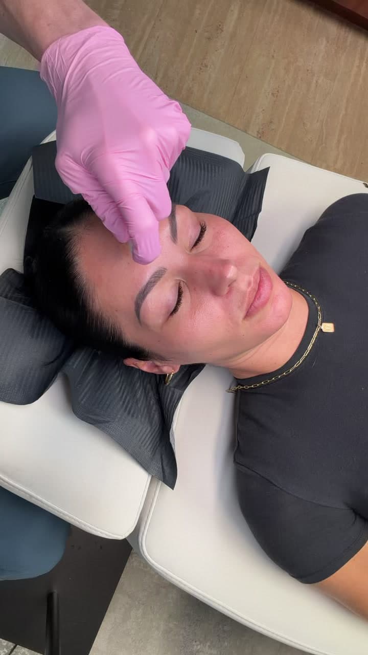 A provider wearing gloves performing a microneedling treatment on a patient in a clinical treatment room.